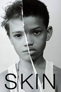 فيلم Skin